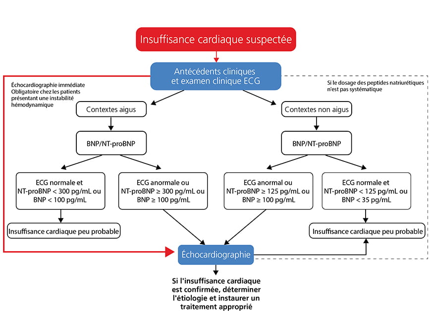 Insuffisance Cardiaque Ecg : DECOMPENSATION CARDIAQUE PDF - Dosage De ...